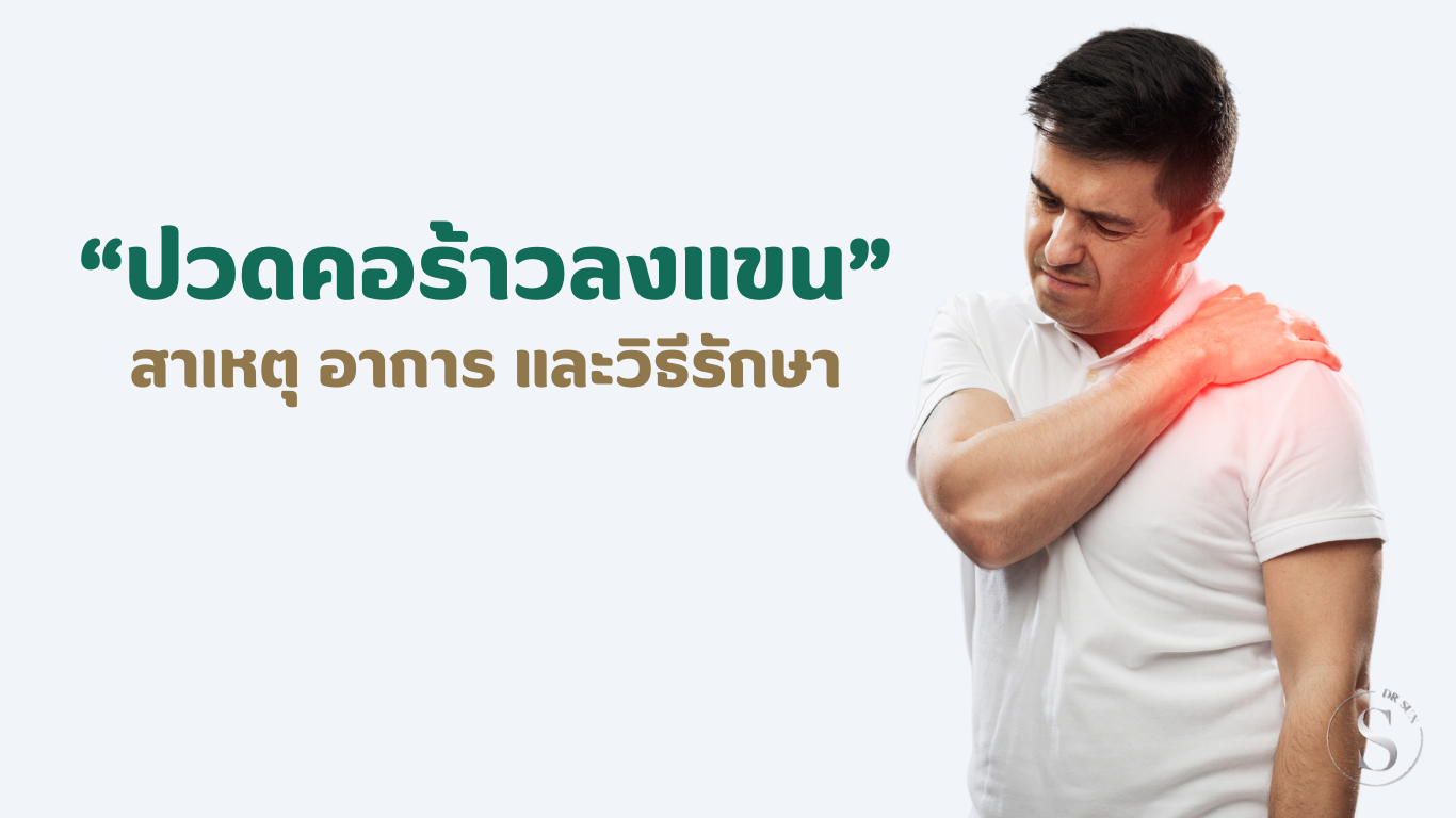 ปวดคอร้าวลงแขน: สาเหตุ อาการ และวิธีรักษา