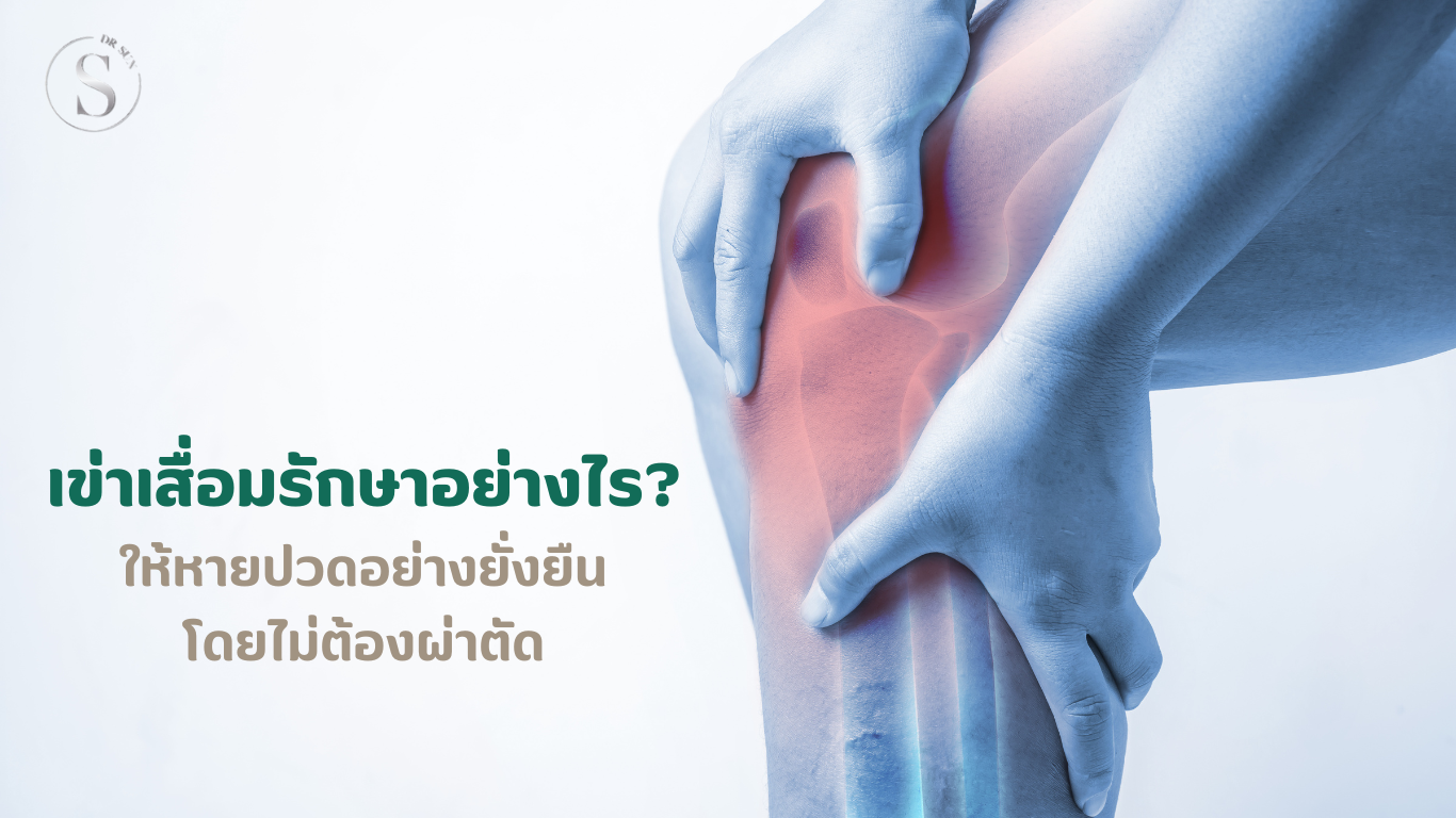 รักษาเข่าเสื่อมอย่างไร ให้หายปวดโดยไม่ต้องผ่าตัด