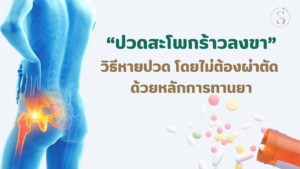 ปวดสะโพกร้าวลงขา: วิธีหายปวดโดยไม่ต้องผ่าตัด ด้วยหลักการทานยา