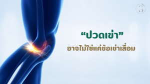 ปวดเข่าอาจไม่ใช่แค่ข้อเข่าเสื่อม