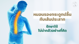 หมอนรองกระดูกปลิ้นทับเส้นประสาท รักษาได้ ไม่น่ากลัวอย่างที่คิด