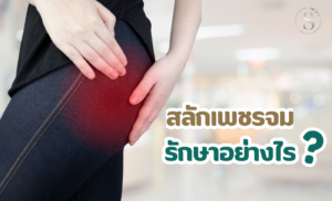 สลักเพชรจม รักษาได้...ไม่ต้องผ่าตัด