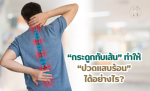 กระดูกทับเส้นทำให้ปวดแสบร้อนได้อย่างไร?