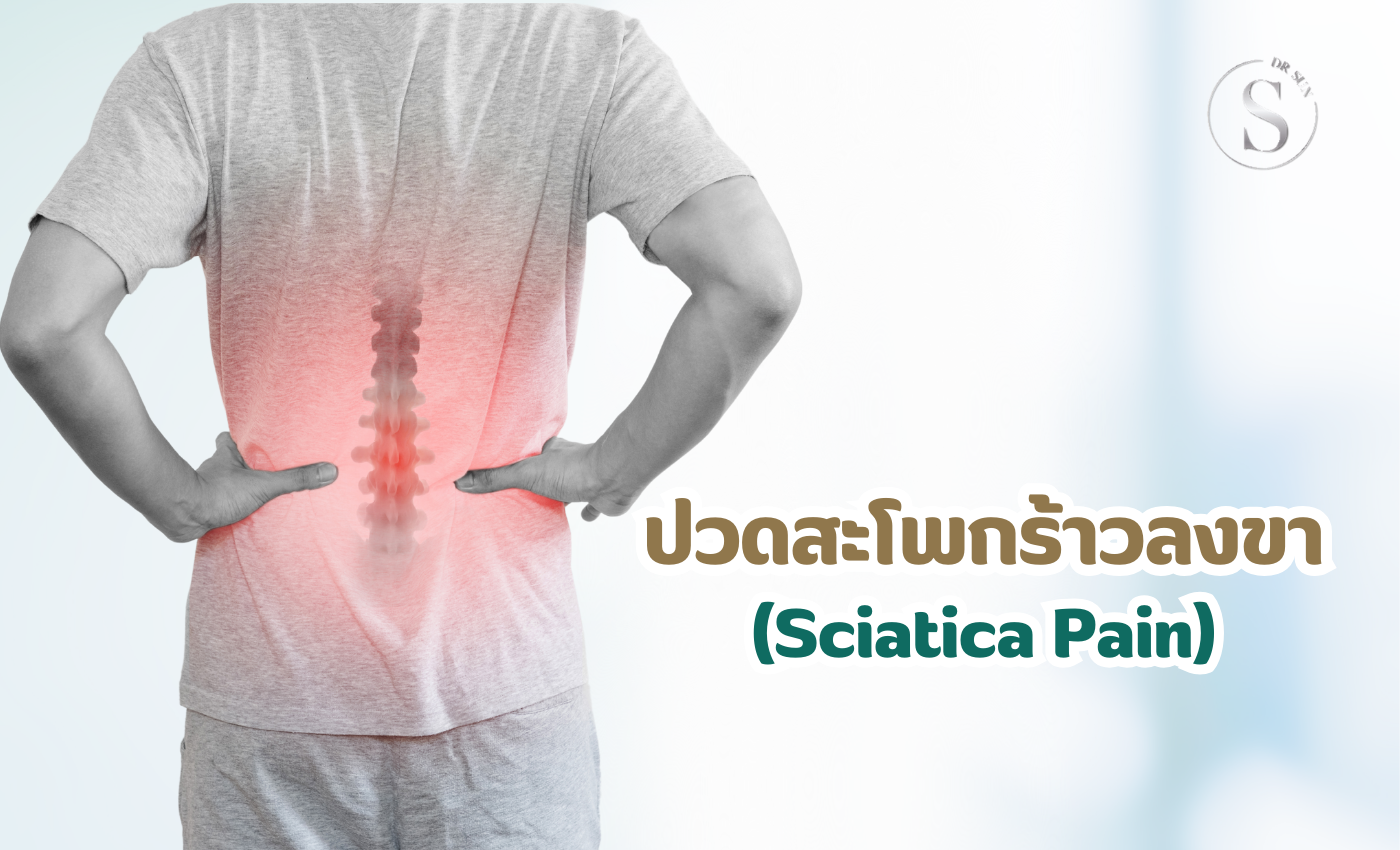 อาการปวดสะโพกร้าวลงขา (Sciatica Pain)