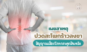 ปวดสะโพกร้าวลงขา อีกหนึ่งสัญญาณเสี่ยงโรคกระดูกสันหลัง