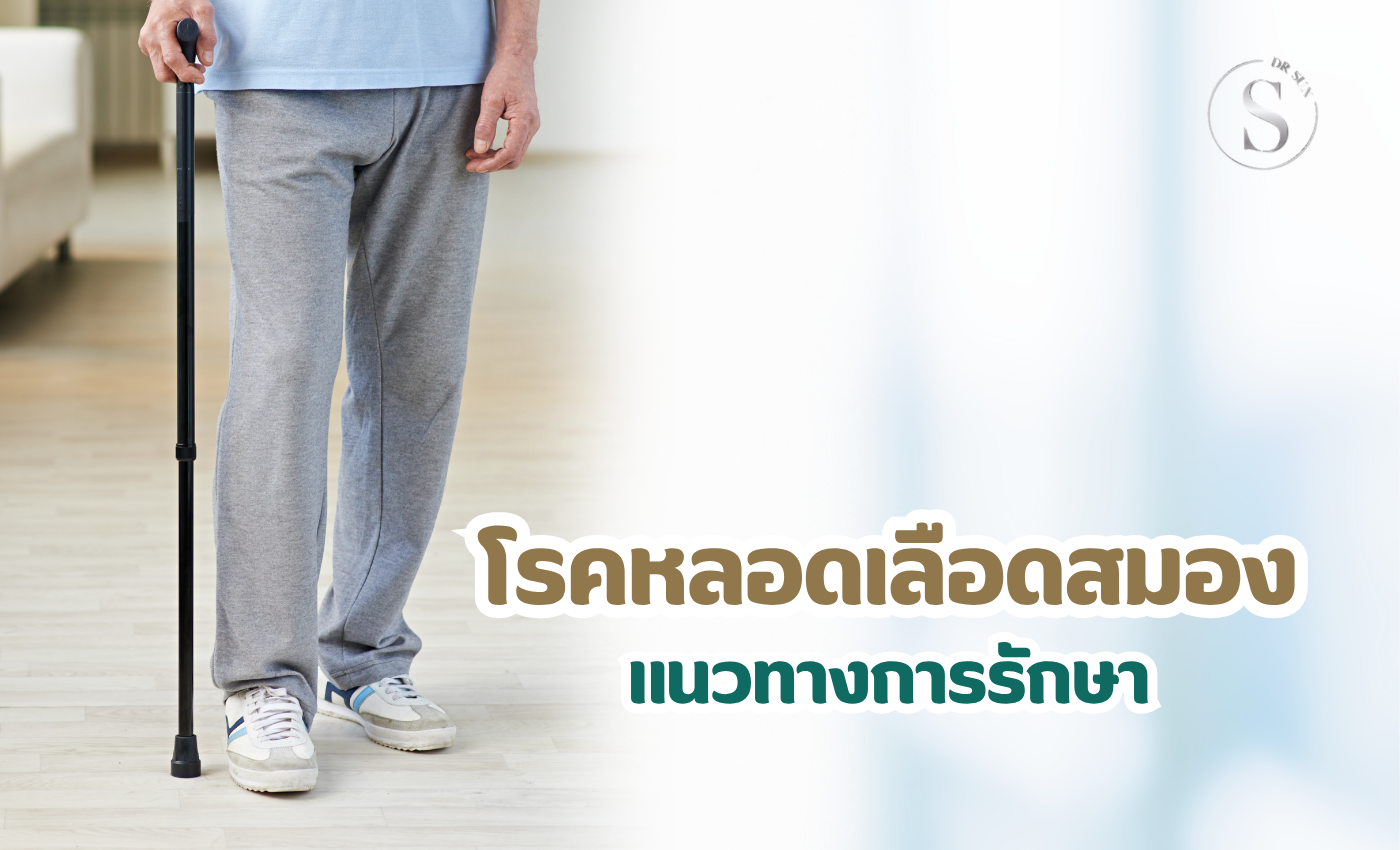 โรคหลอดเลือดสมอง (สโตรก) เงียบแต่ร้ายแรง: 7 สัญญาณเตือนที่ไม่ควรมองข้าม