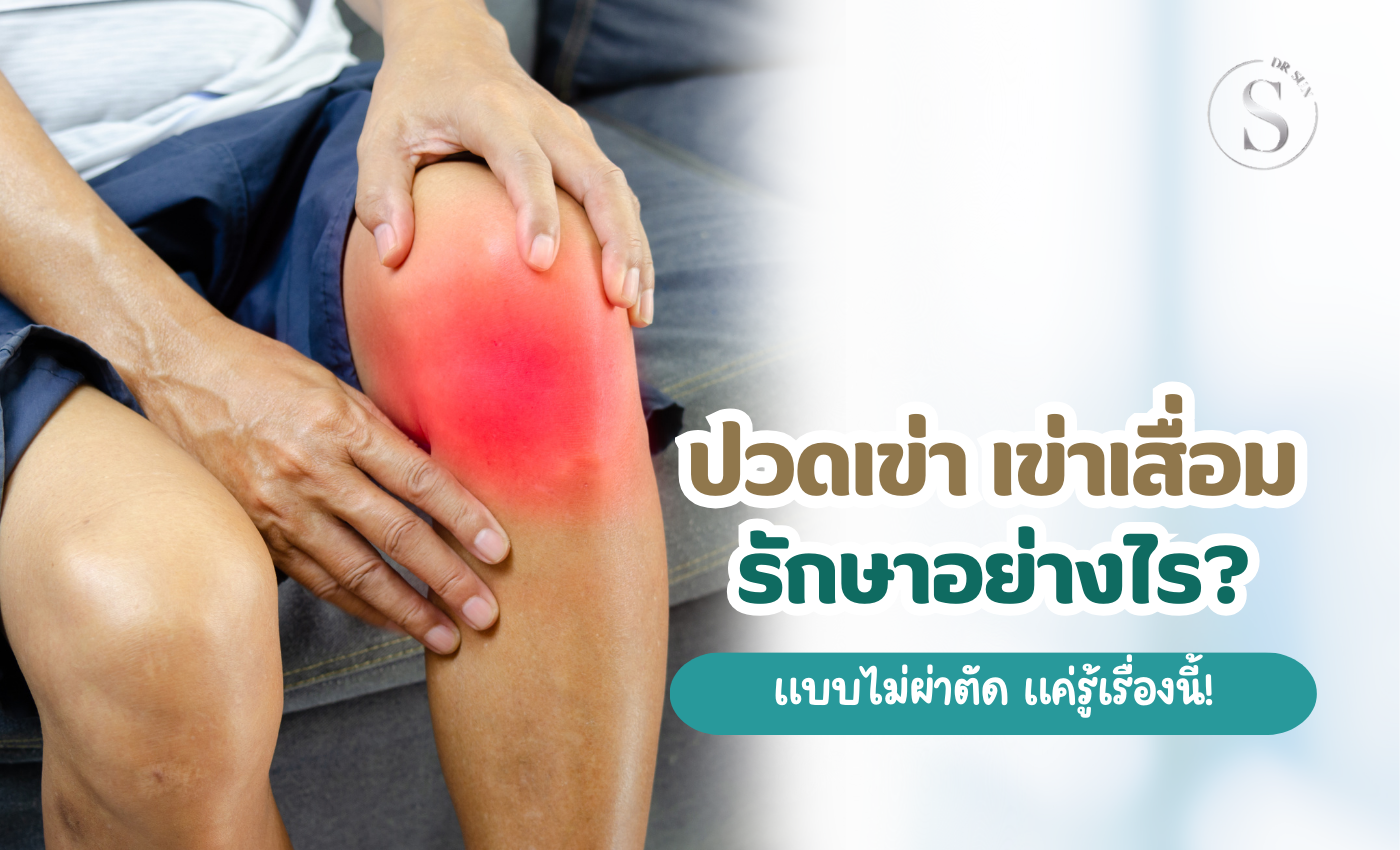ปวดเข่า เข่าเสื่อม รักษาอย่างไรดี เลือกวิธีที่ไม่ต้องผ่าตัด