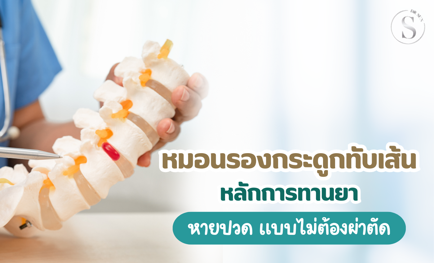 ยารักษา กระดูกทับเส้น กินอย่างไรให้หายปวดและหลีกเลี่ยงการผ่าตัด