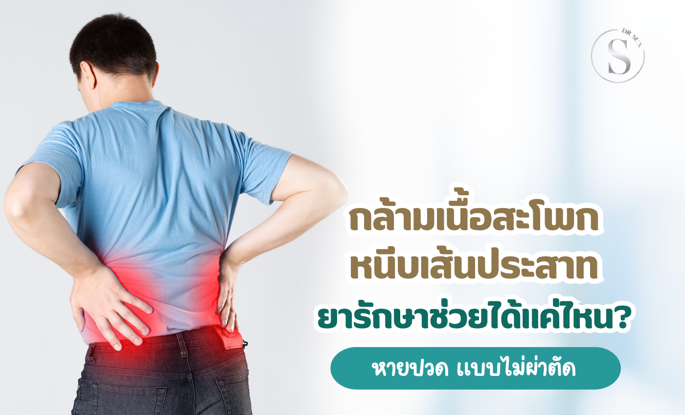 กล้ามเนื้อสะโพกหนีบเส้นประสาท ยารักษาช่วยได้แค่ไหน