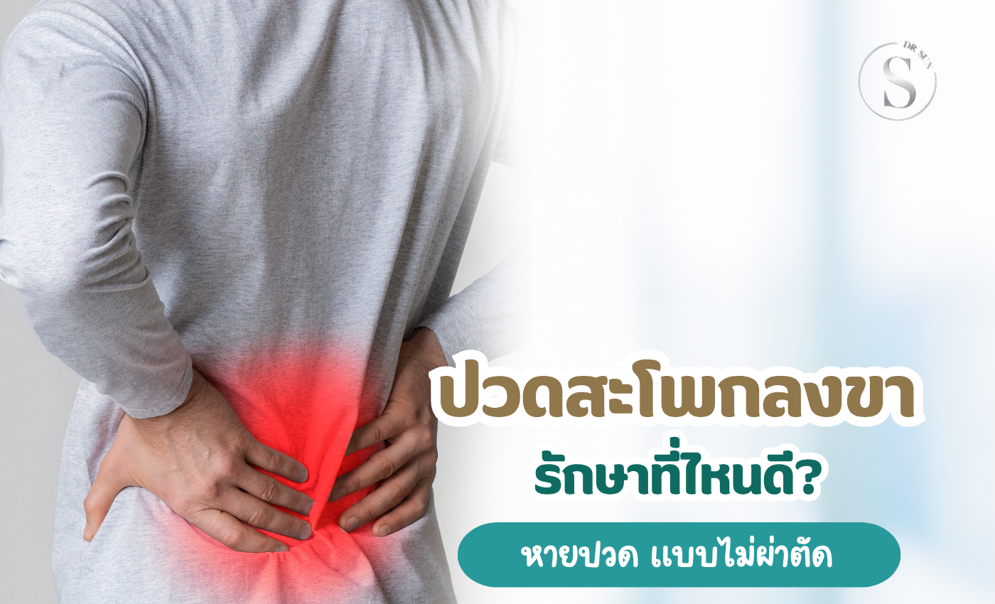 ปวดสะโพกร้าวลงขา รักษาที่ไหนดี คำตอบสำหรับทางเลือกที่ไม่ต้องผ่าตัด